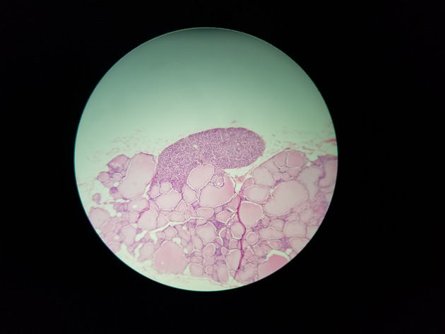 Parathyroid Thyroid Slides - Parathyroid_Thyroid 005 100X